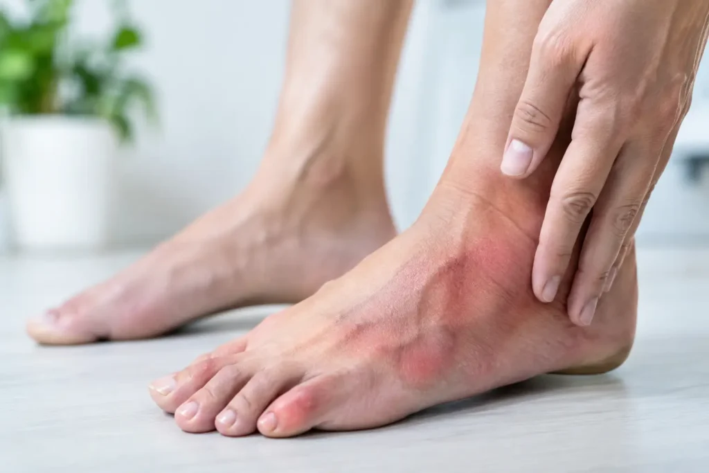 Warning Signs of Foot Infection to Act On 6 Warning Signs of Foot Infection to Act On